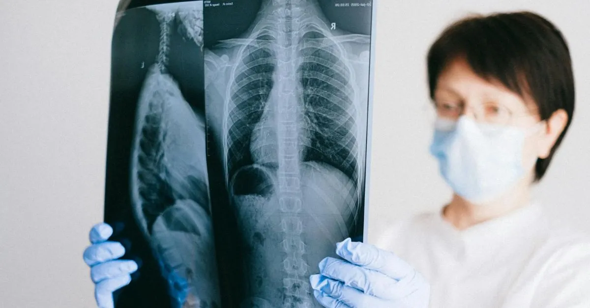 Kanker paru-paru adalah jenis kanker yang paling mematikan di seluruh dunia